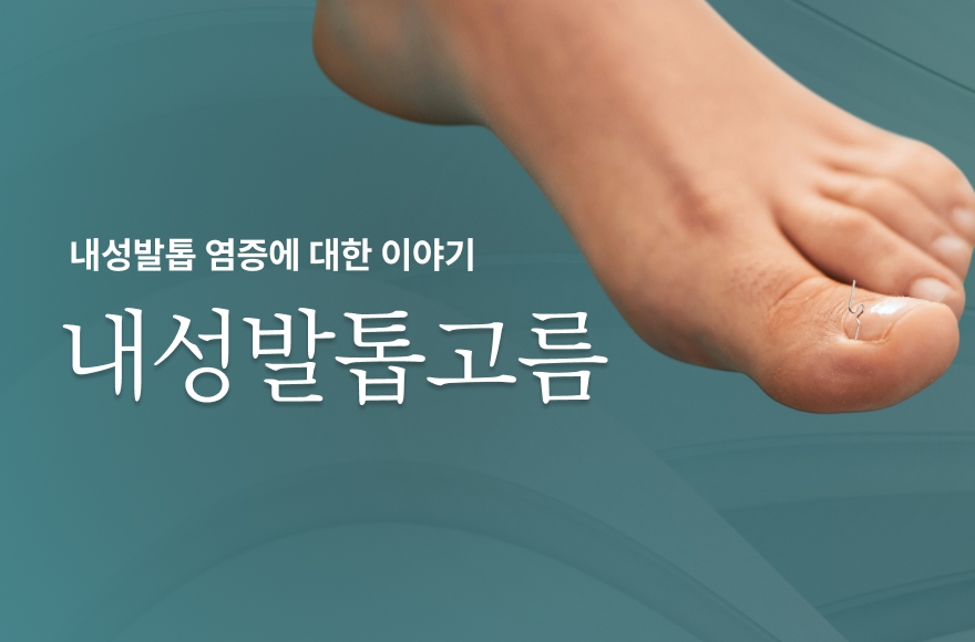 내성발톱 고름과 염증, 가볍게 넘기면 안 되는 이유 