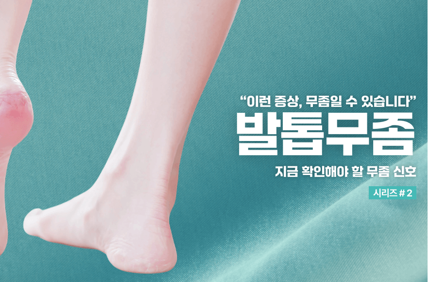 내 발톱이 노래졌다면? 자가진단 체크리스트