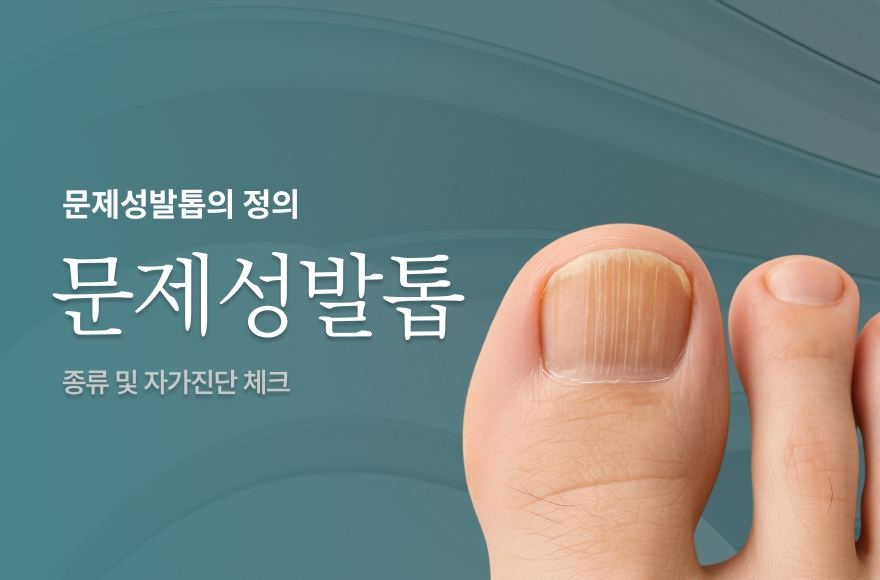문제성발톱이란? 문제성발톱의 종류 및 자가진단 체크